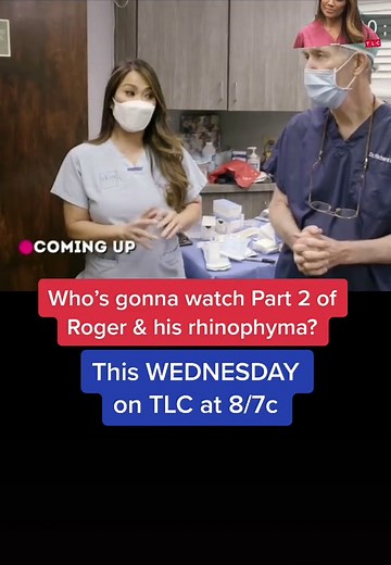 Are you on the edge of your seat? Who’s gonna watch what happens to Roger who has severe rhinophyma? #drpimplepopper #SLMDskincare #pimplepopper