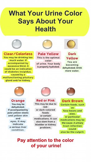 urine color #urine #urinecolor #health | colour