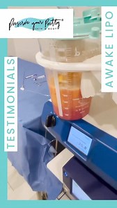 Awake liposuction is a safe way to rid your self of stubborn fat with...