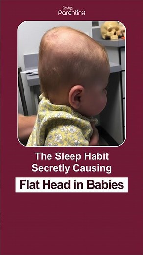 The Sleep Habit Secretly Causing Flat Head in Babies