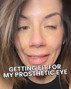 5.5K views · 22 reactions | Watch this incredible moment as a woman gets fitted for a new prosthetic eye ️✨ A powerful reminder of resilience, medical innovation, and the beauty of embracing change with strength and grace. #ProstheticEye #MedicalJourney #InspiringWomen #HealingAndHope #BodyPositivity #RealStories #TransformationTuesday | Awesome Videos | Facebook