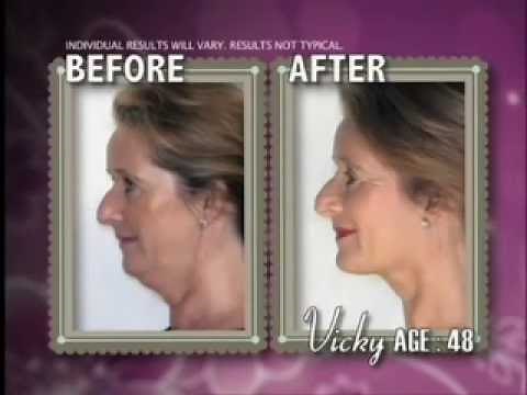 Neckline Slimmer - AS SEEN ON TV - Define Jawline