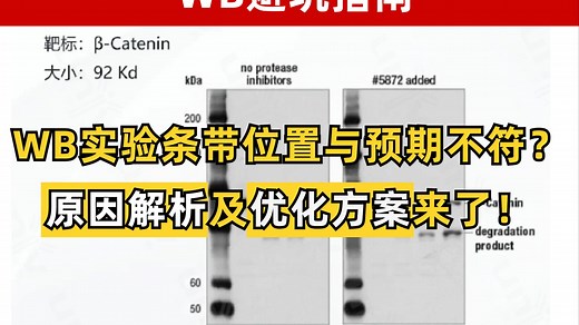 WB成功指南——WB实验条带位置与预期不符原因解析及优化方案