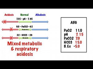 Respiratory: ABG Interpretation