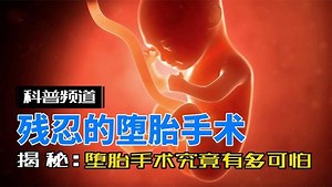 残忍的堕胎手术究竟有多可怕？请广大女性朋友务必保护好自己。#科普一下#冷知识#涨知识