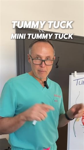 This why muscle repair is so important in a tummy tuck. If you have more questions about what options might be best for you, DM me and let’s schedule your free consultation. • 🏢 Meadows Surgical Arts • 📍Commerce, GA • 📍Buford, GA • 📍Monroe, GA • ☎️ (706) 335-3555 • 📱 Text or call to book | Michael Kluska