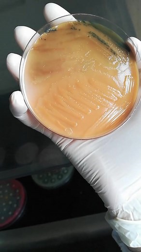 Exploring Bacterial Cultures in a Microbiology Lab