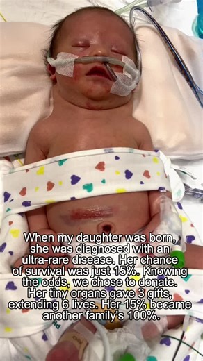 Understanding Organ Donation: A Life-Saving Gift