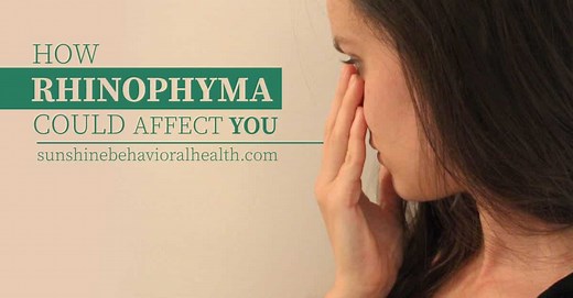 What Is Alcoholic Nose? | Rhinophyma Causes, Symptoms Risks & More