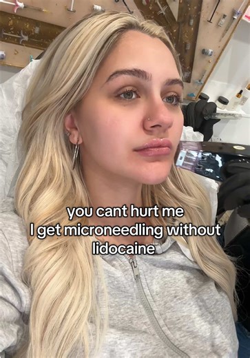 When you want that glow up still but you’re pregnant …you can see my face progressively get more uncomfortable 🤣🤣 #microneedling#skincare