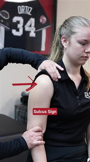 Mike Reinold, DPT, ATC, CSCS, C-PS | Sports Physical Therapist on Instagram: "Sulcus Sign Here's a great example of a test for congenital laxity of the shoulder, the Sulcus Sign. Pretty simple to perform. I'll also use my finger to measure the gap and get a sense of the amount of laxity. You can perform this on the other arm for someone postoperative to get a general sense of their mobility. Want to learn more about shoulder rehab? Comment ‘shoulderkeys’ and I’ll send you a link to my free onlin