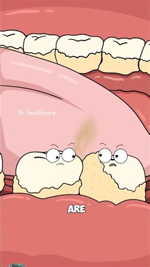 How plaques turns into tartar and why flossing matters #shorts