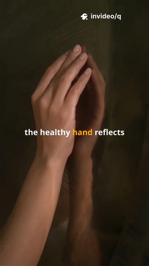 Can You Itch a Hand That Isn’t There? 😱 #Shorts #mbbs #science