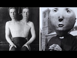 15 Real-Life Circus Freaks Who Defy All Logic