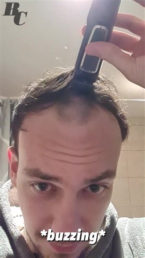 Young Man Embracing His Baldness Transformation