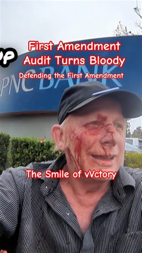 Defending the First Amendment at all Costs - Don't Tread on Me - To the Victor goes the smile