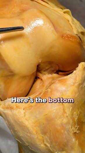 394K views · 3.6K reactions | REAL Human ACL & How It Functions | Institute of Human Anatomy | Facebook