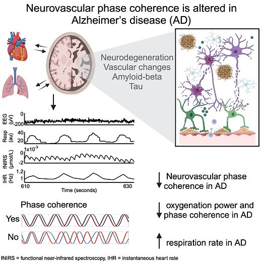 Neurovascular phase coherence is altered in Alzheimer’s disease