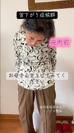 首下がり症候群になってしまった方を施術しました。リックス整体#整体#首下がり症候群#マッサージ