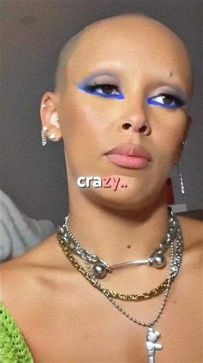 she went bald, then did this 😭🤬