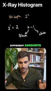 Bit Depth of 1! X-Ray Histograms Explained (Part 2)