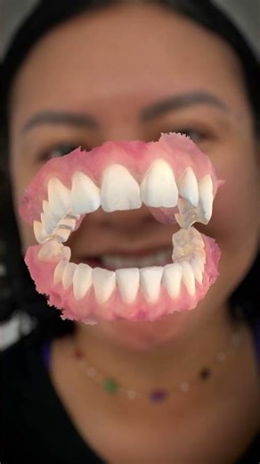 POV: You Finally Got Your SMILE-FX® Braces Off! 🦷✨💃