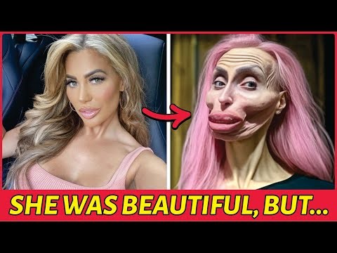 35 Celebrities Who Turned Themselves Into Aliens Because of Botched Plastic Surgery