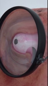 Life size Hans Moleman bust in translucent resin