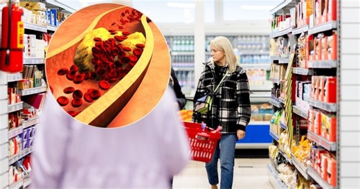 Sumažinkite aukštą cholesterolį: štai kokius produktus verta valgyti