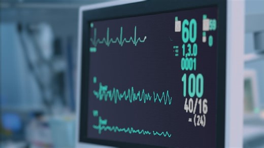 Close up of a heart rate monitor - Free Stock Video