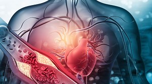 5 conseils pour améliorer sa circulation sanguine