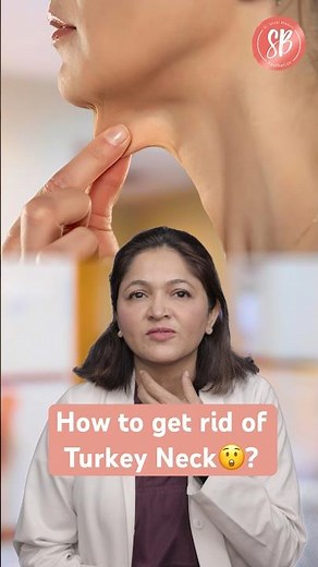 What is turkey neck? How to get rid of turkey neck? #shorts #youtube #sbaesthetics #drshilpibhadani