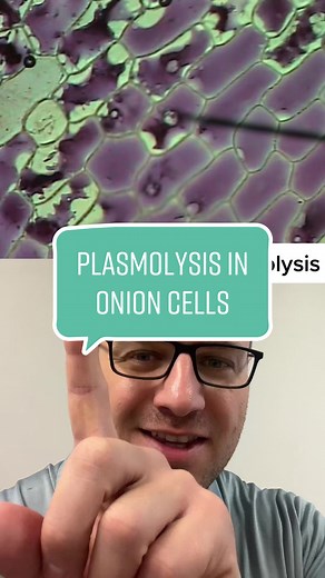 Understanding Plasmolysis in Onion Cells