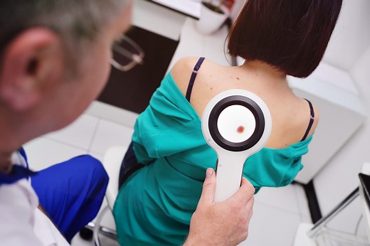 Les taches suspectes d'un cancer de la peau en photos