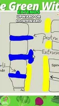 Back Pain? See How Discs Degenerate in This Video! #shorts