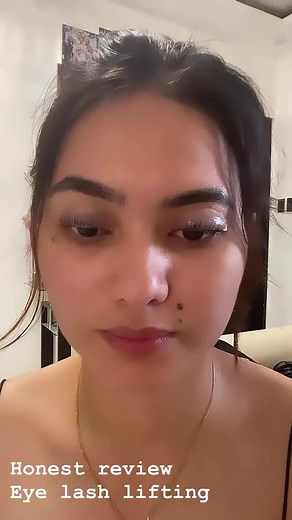 #trusttheprocess #eyelift #model #modeling #honestreview | Anya Aragon