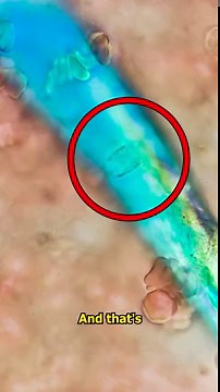 White Blood Cells vs Microplastics