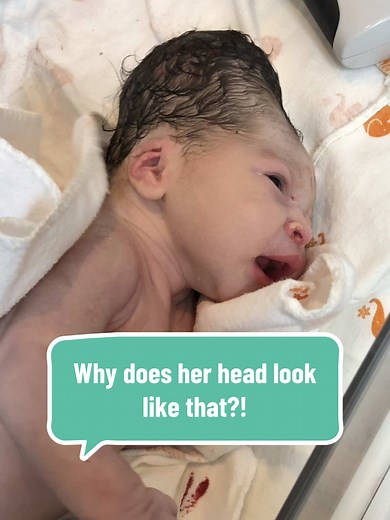 Replying to @Reena Baby🩷😘 and this is one reason why we put a baby hat on newborns 🥴😆 #conehead #newmom #newparent #firsttimemom #newborn #jumpscare #pregnant #birthstory #newdad #shocked #molding