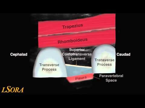 LSORA: paravertebral block (US guided) tutorial