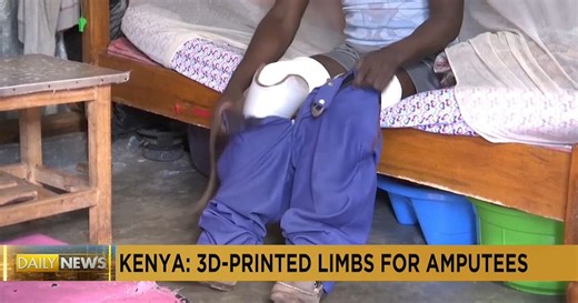 Kenyan company becomes country’s first to 3D print prosthetic limbs | Africanews