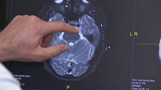 Study: Screen time on social media can disrupt emotional control in the brain