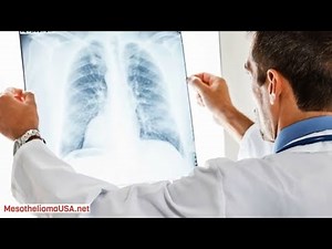 How Does Asbestos Cause Mesothelioma? - Mesothelioma and Asbestos Exposure