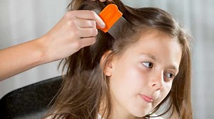 Mayo Clinic Minute: How to Get Rid of Super Lice - Mayo Clinic News Network