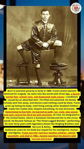 THE MAN WITH THREE LEGS WHO TURNED FATE INTO LEGEND