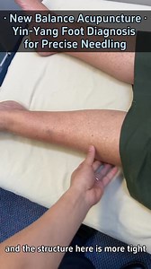 6.9K views · 12 reactions | In New Balance Acupuncture (NBA), we...