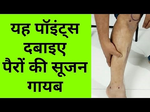 Acupressure Points For LEG SWELLING/ EDEMA / Reduce Leg Swelling FAST / Press Points For 2 Minutes
