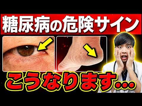 【放置危険】進行する前に知って欲しい『隠れ糖尿病』の初期症状･危険サイン７選【セルフチェック法を医師解説】