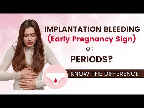 Is It Implantation Bleeding (Early Pregnancy Signs) or Period? | How to Tell the Difference