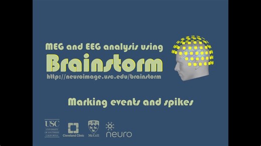 Brainstorm 对癫痫EEG进行溯源分析