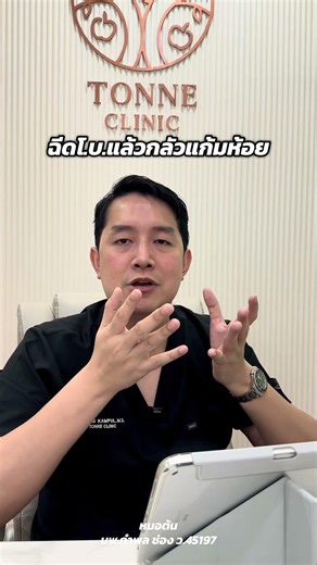 โปรแกรมฉีดโบท็อกซ์กลัวแก้มห้อย #tonneclinic #ต้นเน่คลินิก #คลินิกความงาม #botox #ลดกราม #ยกกระชับ